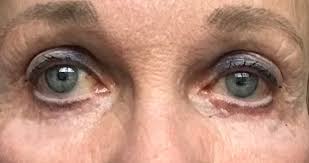 Eyes Reflect Vitality When Three Whites Sanpaku Can Be A Red Flag Rebecca Wood Sanpaku (三白) is a japanese term meaning three whites. eyes reflect vitality when three