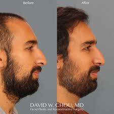 This patient of mine wanted to focus