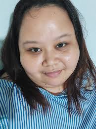 How was your recovery after having both knees done at the same time?