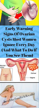 Pin By Doris St Cyr On Healthy Ovarian Cyst Ovary Cancer Ovarian
