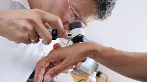 Lebensjahr können sich immer wieder neue muttermale bilden. Hautkrebsgefahr Diese Muttermale Leberflecke Co Konnen Gefahrlich Sein Gesundheit