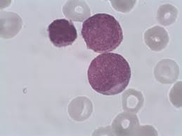 Choose from white blood cell under microscope pics stock illustrations from istock. How Many Stem Cells Are There In A Stem Cell Product Ptb De