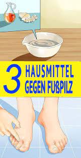 Die 3 Besten Hausmittel Gegen Fusspilz Fusspilz Hausmittel Hausmittel Fusspilz