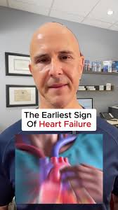 Understanding Your Osteoarthritis Type and Symptoms