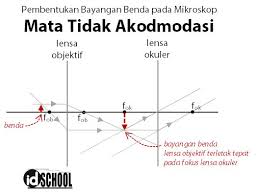 Suatu mikroskop terdiri dari dua lensa cembung. Cara Menghitung Perbesaran Pada Mikroskop Idschool