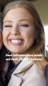 How I Reduced Face Inflammation: 6 Easy Lifestyle Changes