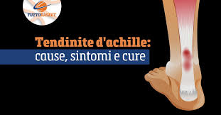 Quando parliamo di trattamento di tendiniti e tendinopatie , non possiamo non pensare al trattamento con onde d'urto tendine d'achille, il tendine più grande, e robusto che abbiamo. Tendinite D Achille Cause Sintomi E Cure
