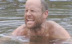 Survivor's first medevac: Michael Skupin falls in the fire during Survivor:  The Australian Outback