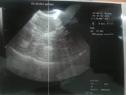 Bebas pakai untuk komersil, blog, desain. My Wife Pregnancy Asyrani Com