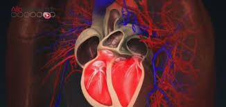 L'insuffisance cardiaque est une pathologie dans laquelle le muscle cardiaque est affaibli et n'est plus capable de pomper efficacement le votre médecin examinera vos antécédents médicaux, notamment vos maladies antérieures et actuelles, vos antécédents familiaux et votre mode de vie. L Insuffisance Cardiaque Une Maladie Irreversible
