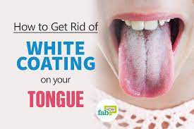 How To Get Rid Of A White Coated Tongue With Just 1 Ingredient White Tongue White Coated Tongue White Tongue Causes