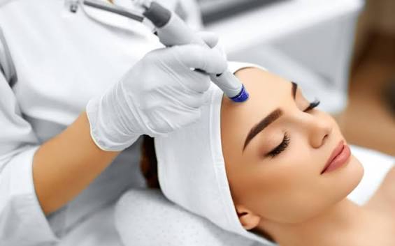 Dermapen treatment