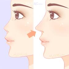 And don't forget, our service is completely free! 47 Best Rhinoplasty In Malaysia Price Guide Reviews