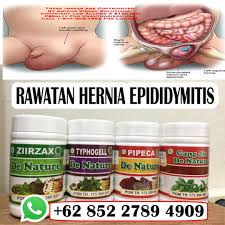 Lemak akan keluar ketika buang air besar, buang angin atau meleleh begitu sahaja. Cara Atasi Sakit Uluran Medu Angin Herniaubat Dan Rawatan Berkesan Ubat Herba Berkesan Ubat Angin Pasang Ubat Turun Berok Ubat Epididymitis Ubat Hernia