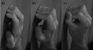 Double Overhand Deadlifts. Doing them? - Page 2 - Exodus Strength