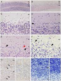 Histological Findings Within The Cerebellar Cortex Of Affected Dogs Download Scientific Diagram