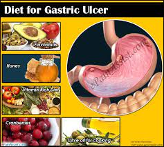 The healthy diet for duodenal ulcer patients include fruits, veggies, grains, fat free dairy products, pasta, whole wheat bread, cereals, brown rice, beans, eggs, lean meats, fish, eggs, and poultry. Diet For Gastric Ulcer Flavonoids Honey Vitamins Cranberries Olive Oil