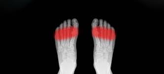 It can happen anywhere in the feet. Ski Boots Why Do My Feet Hurt Ellis Brigham Blog Ellis Brigham Mountain Sports