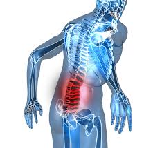 Pin On Pinched Nerve In Lower Back
