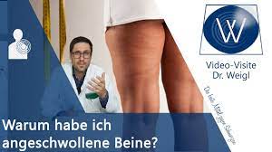 Beinodeme Geschwollene Dicke Beine Wasser In Den Beinen Durch Hitze Herzinsuffizienz Lymphodem Youtube