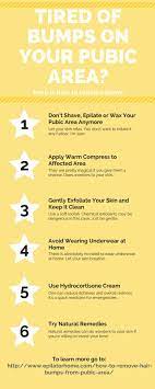 Pin On Beautyblogboard