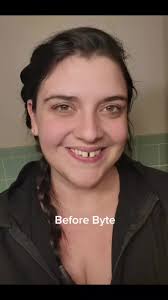 Brightbyte Pro Whitening Before and After