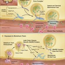 Symptoms include weakness, dizziness, constipation, nausea, vomiting and dry mouth. Pdf Botulinum Toxin As A Biological Weaponmedical And Public Health Management
