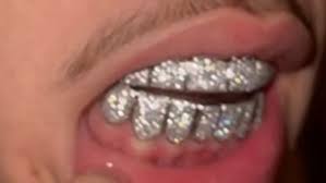 Harden has been an extremely durable player throughout his career, and often rejected attempts to have him rest down the. Nba Lamelo Ball Shows Off The Most Expensive Teeth In The Nba Marca