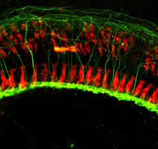 Image result for Warneckea sansibarica