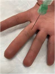 Image result for Digital Block