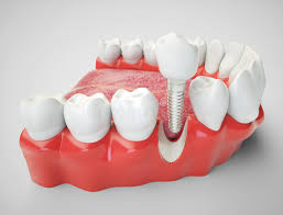Join millions of seniors across the nation & start saving 241 021 Dental Photos Free Royalty Free Stock Photos From Dreamstime