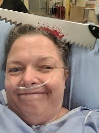 From Kathy Barber Stuckey: Keith had his colonoscopy today NO blockages and  Doctor saw NO cancer However he removed 2 polyps and they will be sent off  for biopsy, but Dr said