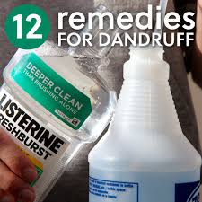 12 Homemade Dandruff Treatments Shampoos Everyday Roots