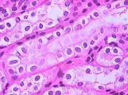 We did not find results for: If There Was No Nucleus In An Animal Cell Then What Would Happen Quora