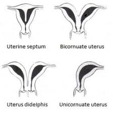 Image result for uterus