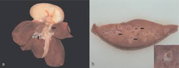 Scielo Brasil Feline Platynosomiasis Analysis Of The Association Of Infection Levels With Pathological And Biochemical Findings Feline Platynosomiasis Analysis Of The Association Of Infection Levels With Pathological And Biochemical Findings