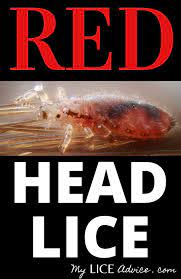 Red Lice Why Are Some Head Lice Red Head Louse Louse Lice Remedies