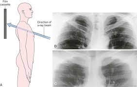 We did not find results for: Cxr Basics By Sanjay Nadesan Infographic