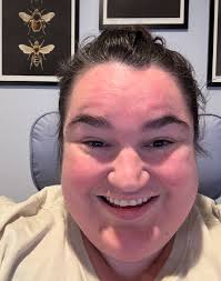 Can you see weight loss difference in my face?