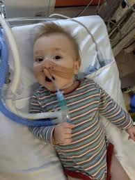 Image result for Infant Botulism