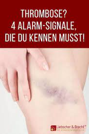 Elle peut être une thrombose artérielle : Thrombose Verdacht Diese 4 Anzeichen Verraten Es Schmerz Beinschmerzen Gelenkschmerzen