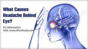 What Can Cause Headache Behind Eyes Backpainquotes Headache Behind Eyes Headache Getting Rid Of Headaches