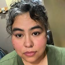 Work accommodations for keratoconus?