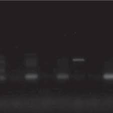 One camel in alaska al basim. Pdf Molecular Diagnosis Of Brucellosis In Camels By Conventional Polymerase Chain Reaction In Wasit Province Iraq