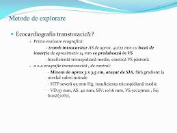 Ale subdiviziunilor din imsp spitalul clinic republican. Ppt Fibrila Å£ Ia Atrial Äƒ C Äƒ L Äƒ Uz Äƒ I N Descoperirea Mixomului Atrial Powerpoint Presentation Id 4057082