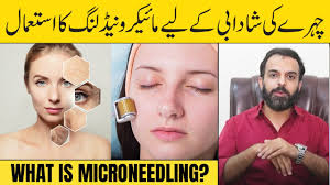 What is Microneedling?