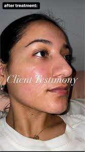 Jean Acuña (@ja_skintherapy) · Austin, TX