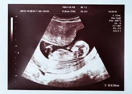 High frequency sound waves are used to scan the high frequency sound waves are used to scan the expectant mother's abdomen and pelvic cavity, to create a picture of the fetus and placenta. Weeks Gestation Photos Free Royalty Free Stock Photos From Dreamstime