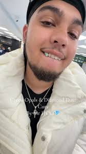 Custom Grillz and Jewellery by Mr HOG