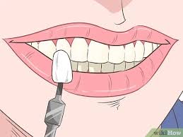 How to fix crooked bottom teeth without braces. How To Straighten Your Teeth Without Braces With Pictures
